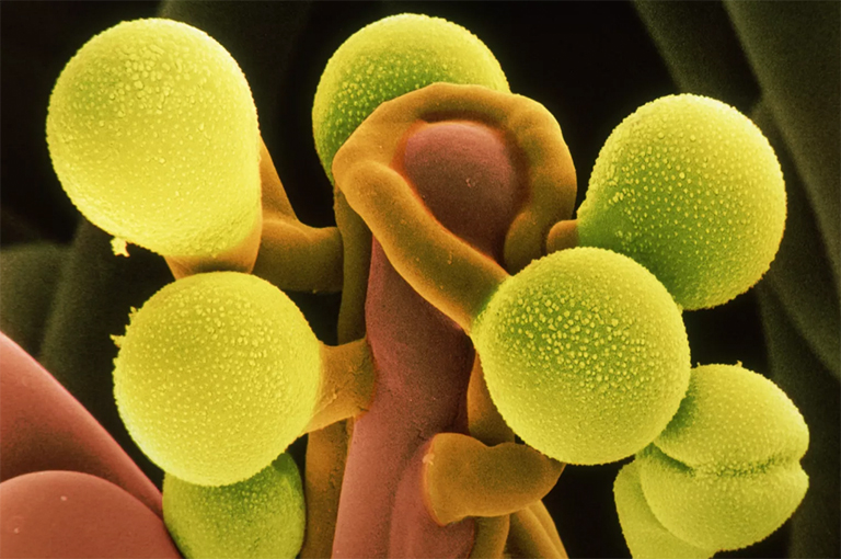 罂粟花粉粒.jpg 罂粟花粉粒