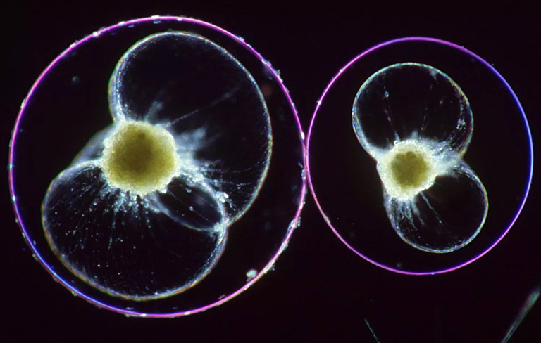 鞭毛虫.jpg 鞭毛虫