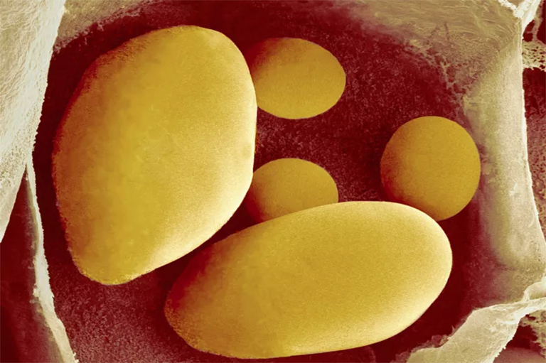 淀粉糊质.jpg 淀粉糊质